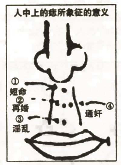 人中下方有痣的女性无法守住贞洁到结婚吗?