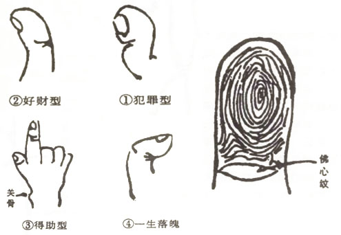 整个拇指向外弯曲男性会因赌而身败名裂吗?