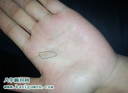 什么是岛纹，手掌岛纹有哪些吉凶意义?