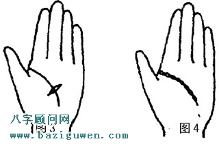 智慧线看健康3.4