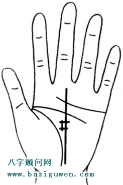 命运线上出现方块纹