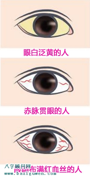 从眼白看健康