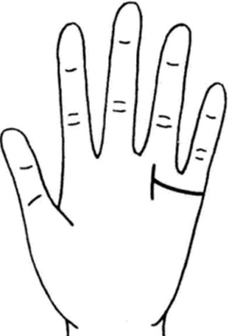 婚姻线很长又很清晰，到达太阳线的情况